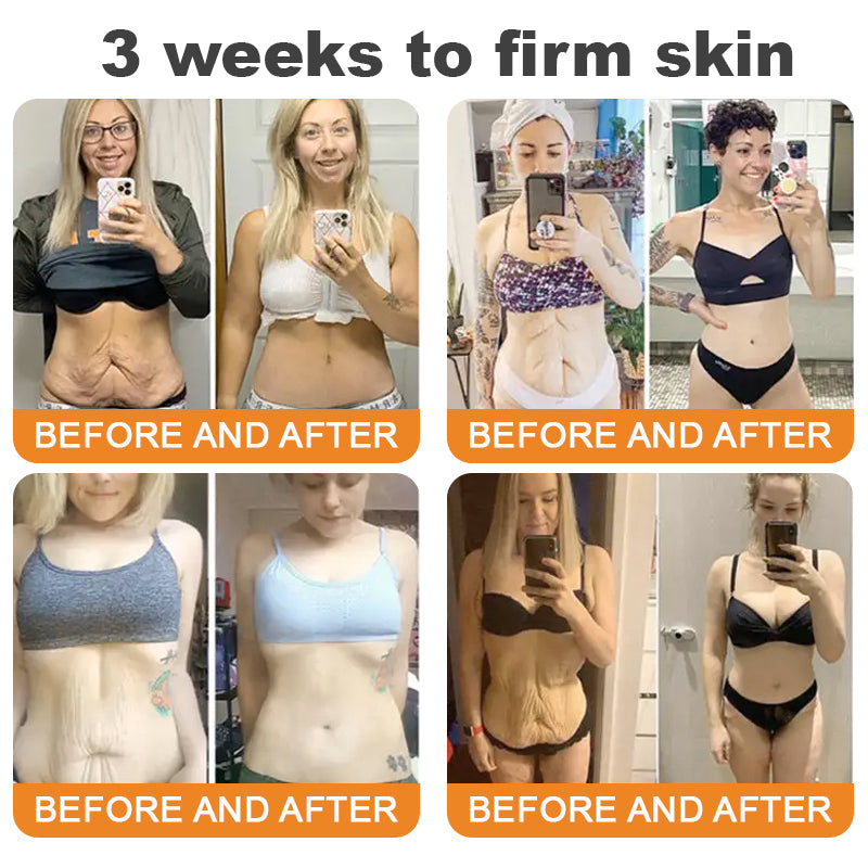 Made and Shipped from USA 🥑 DarkFairy® Bee Venom Skin Restoration Cream ⏰ LAST DAY 80% OFF