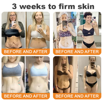 Made and Shipped from USA 🥑 DarkFairy® Bee Venom Skin Restoration Cream ⏰ LAST DAY 80% OFF