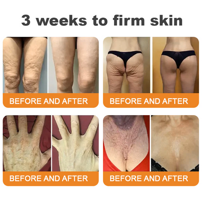 Made and Shipped from USA 🥑 DarkFairy® Bee Venom Skin Restoration Cream ⏰ LAST DAY 80% OFF