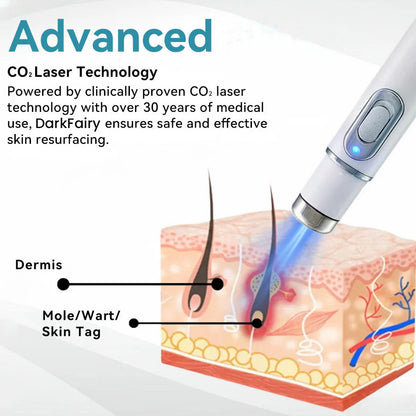 （Last day 50% off）DarkFairy™ Medical-Grade Laser Pen 🌏 (Powered by CO₂ laser technology – effectively removes moles, warts, skin tags, pigmentation spots, and other skin imperfections)🔥